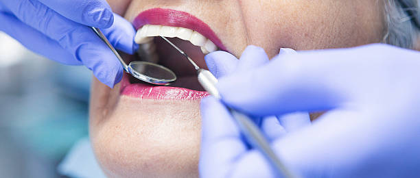 Best Pediatric Emergency Dentist in Palm Springs, FL